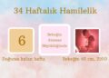 34 haftalık hamilelik