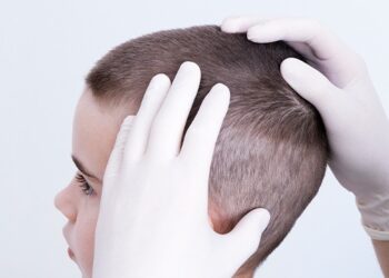 bite karşı yapılması gerekenler ve önleme yöntemleri nelerdir